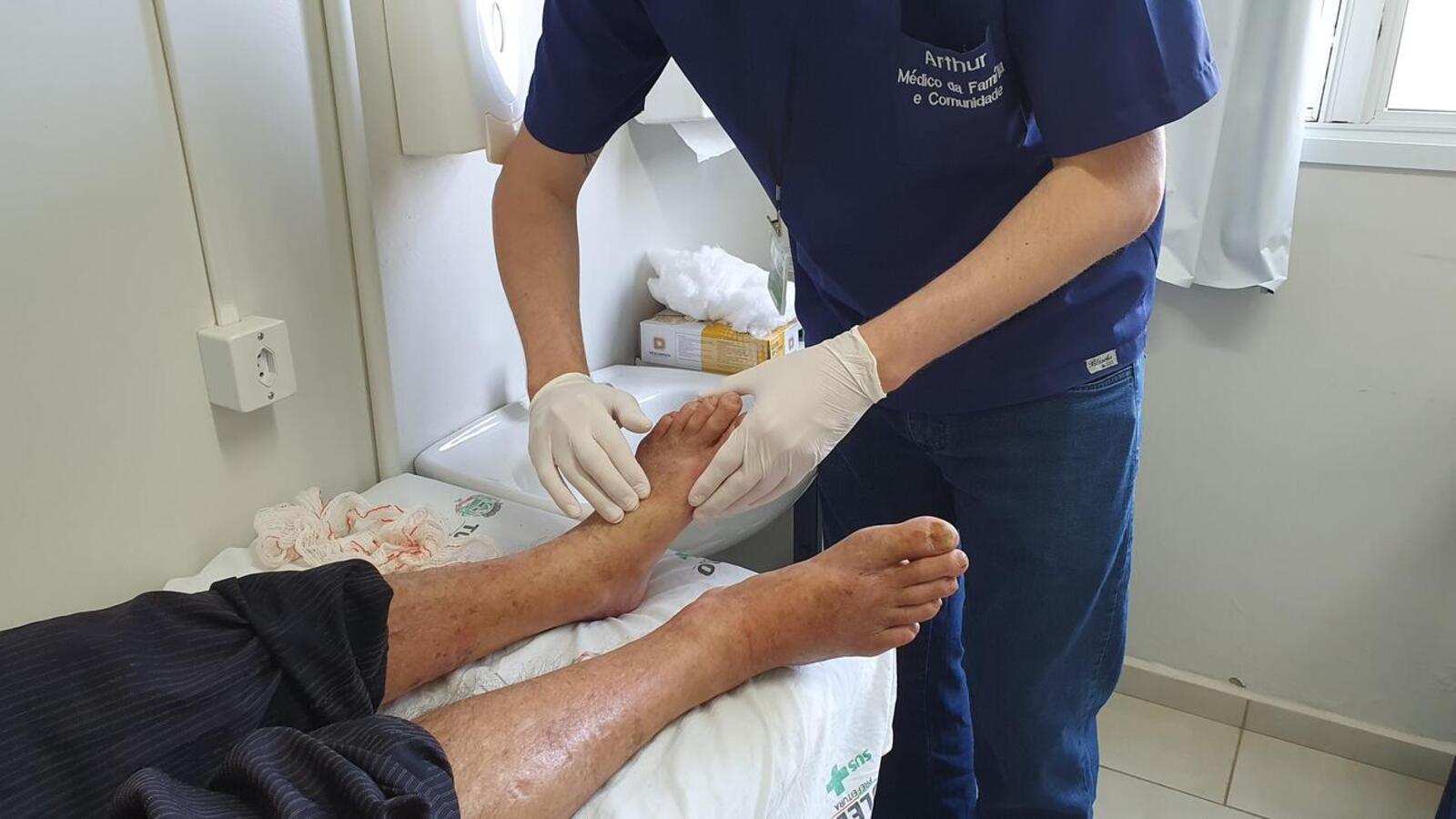 Ação consiste em avaliação clínica de pés diabéticos, com objetivo de prevenir maiores complicações, como amputação dos membros